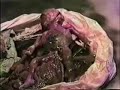 la vida con un aborto