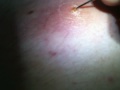 Cyst 2.4