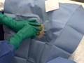 Bone Marrow Biopsy