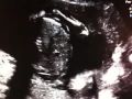 Baby Gray 20 Week