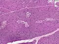 Histolog�a - Par�tida