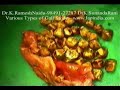 Short Clips of Various Laparoscopy / Keyhole Surgeries Short Clips of Various Laparoscopy / Keyhole Surgeries