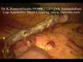 Short Clips of Various Laparoscopy / Keyhole Surgeries