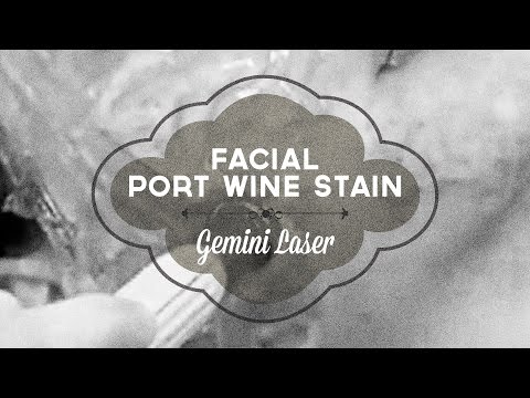 Port wine stain treatment with the ...