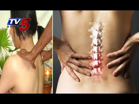 how to cure spondylitis