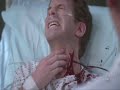 Carotid artery bursts.