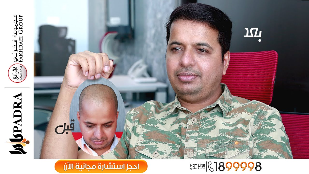 مركز بادرا لزراعة الشعر - Padra Clinic Hair Transplant - पादरा क्लिनिक हेयर ट्रांसप्लांट