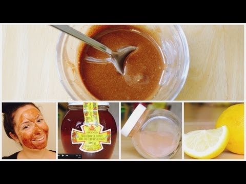 And diy AMAZING clearing Mask acne Face Trusper  mask For  Acne Scarring  DIY