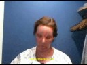 Michael Persky, MD - Fraxel re:pair with Marta Waller 3 Michael Persky, MD - Fraxel re:pair with Marta Waller 3
