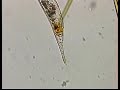 UROSOMA CIENKOWSKII CILIATE