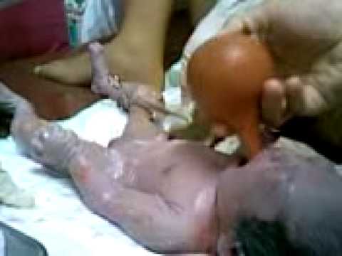 parturition -