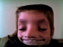 Thumbnail #1