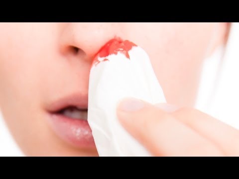 how to stop nose bleed from running