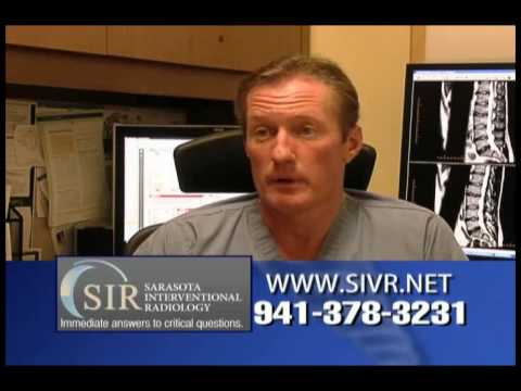 Disk Biacuplasty using Radiofrequency Technology for Lower Back Pain