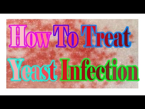 how to relieve yeast infection symptoms