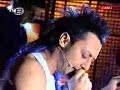 hayko cepkin yaras? sakl? tv8 balbal show hayko cepkin yaras? sakl? tv8 balbal show