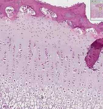 Shotgun Histology Endochondral ...