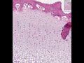 Shotgun Histology Endochondral Ossification