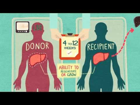 how to get a liver transplant