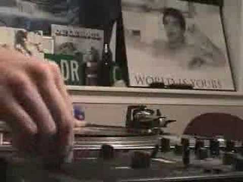 PROLIFIC CUTS WITH BROKEN FINGER