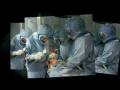 videos de Total Knee Replacement Surgery India