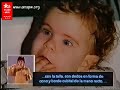 síndrome de prader willi  uned tv 1999   1/3 
