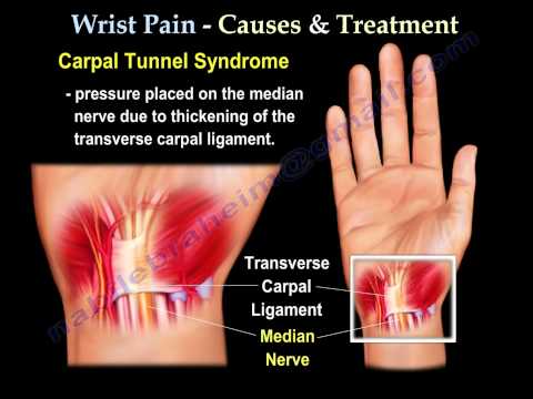 how to cure wrist pain