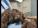 My Shocking Story: Treeman the Cure - Hospital Life My Shocking Story: Treeman the Cure - Hospital Life
