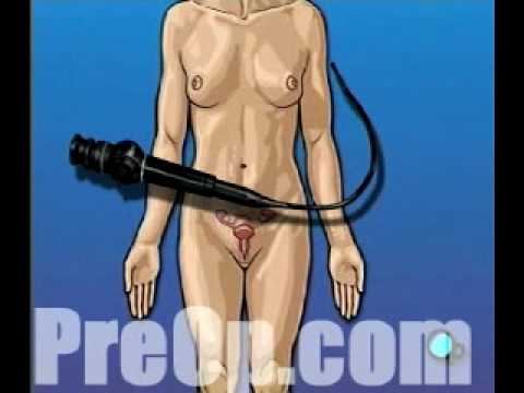 vulva inspection