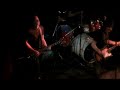 beau-black-performing-at-alex-bands-donate-life-rocks.html