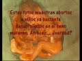 Trizte Historia del Aborto