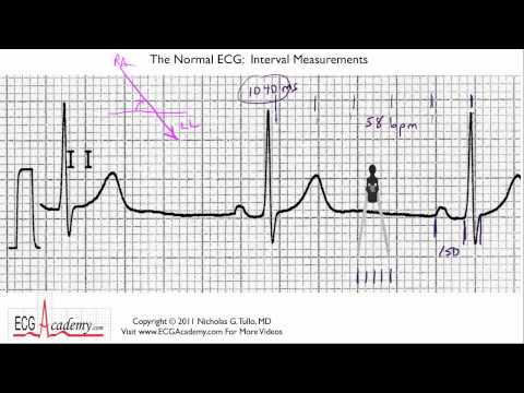 how to measure the p-r interval