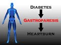Conditions That Cause Heartburn (Health Short)