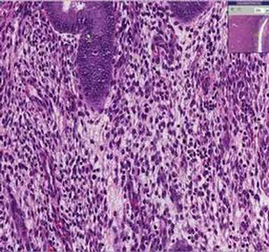 endometrium - Histopathology Uterus, endometrium--Proliferative endometrium.