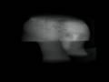 DRR  Digitally Reconstructed Radiographs  Test 2