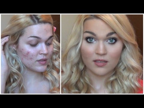 Everyday Acne Coverage Foundation Routine + Contouring For Flawless Skin