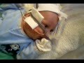 cute twin baby, Thomas Govier