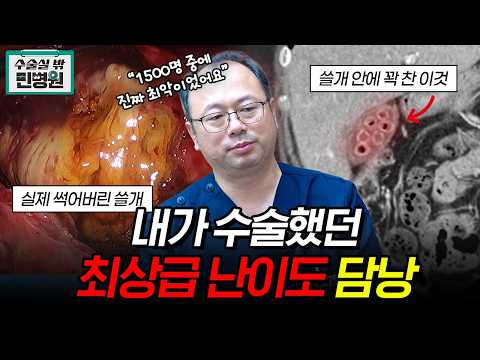 명치, 윗배 통증 방치하면 100% 이렇게 됩니다, 쓸개 터지기 전에 검사 받..