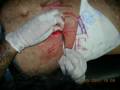 slayer scarification by el amigo, made in el salvador c.a. slayer scarification by el amigo, made in el salvador c.a.