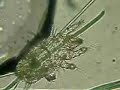 Water Mite (Nymph stage)