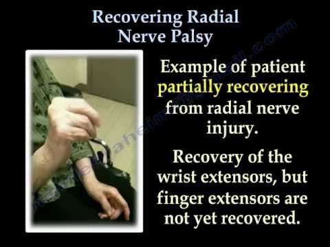 how to relieve radial nerve pain