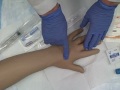 Intravenous (IV) Saline Lock Insertion