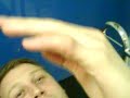 Hoddesdon Goalkeeper Chris Fitkin dislocates his finger 1 Hoddesdon Goalkeeper Chris Fitkin dislocates his finger 1