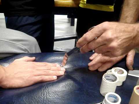 how to treat sprained thumb