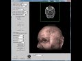 Click here to watch this video Brain MRI Volume Data processing and visualization