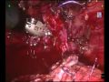 Prostatectomia radicale robotica ASL 9 Urologia Grosseto