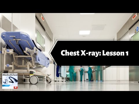 how to read chest x ray