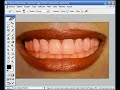 Tutoriales Photoshop -  Blanquear dientes