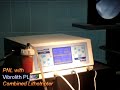 Kidney Stone treatment by PNL with Vibrolith PLUS video 3