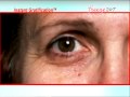 Freeze 24-7 Treatment Kit